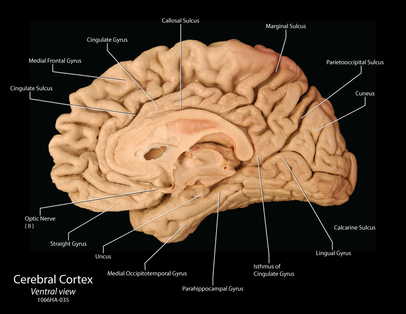 real brain labeled