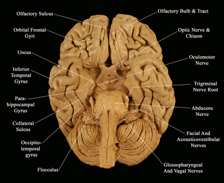 real brain labelled