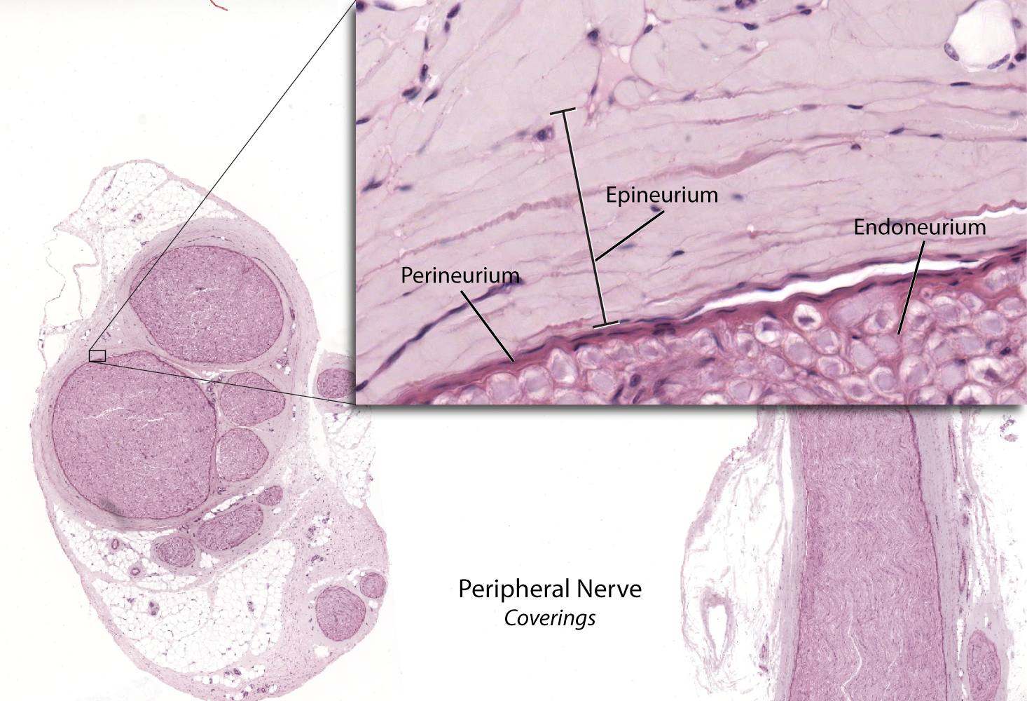 nerve fiber with schwann cell cross section